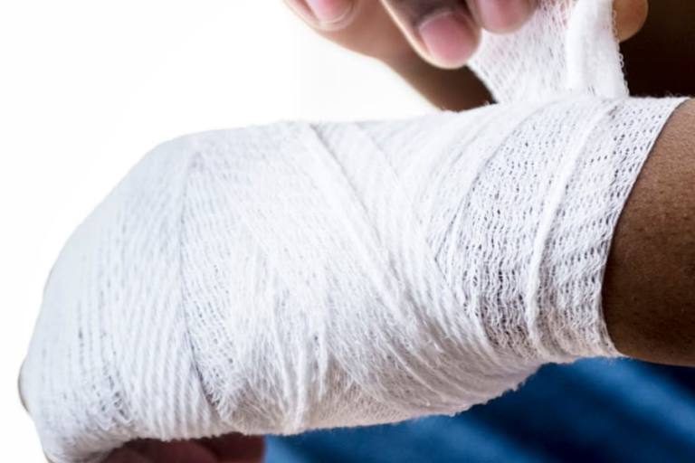 Los vendajes con caseína de leche de vaca poseen propiedades curativas.